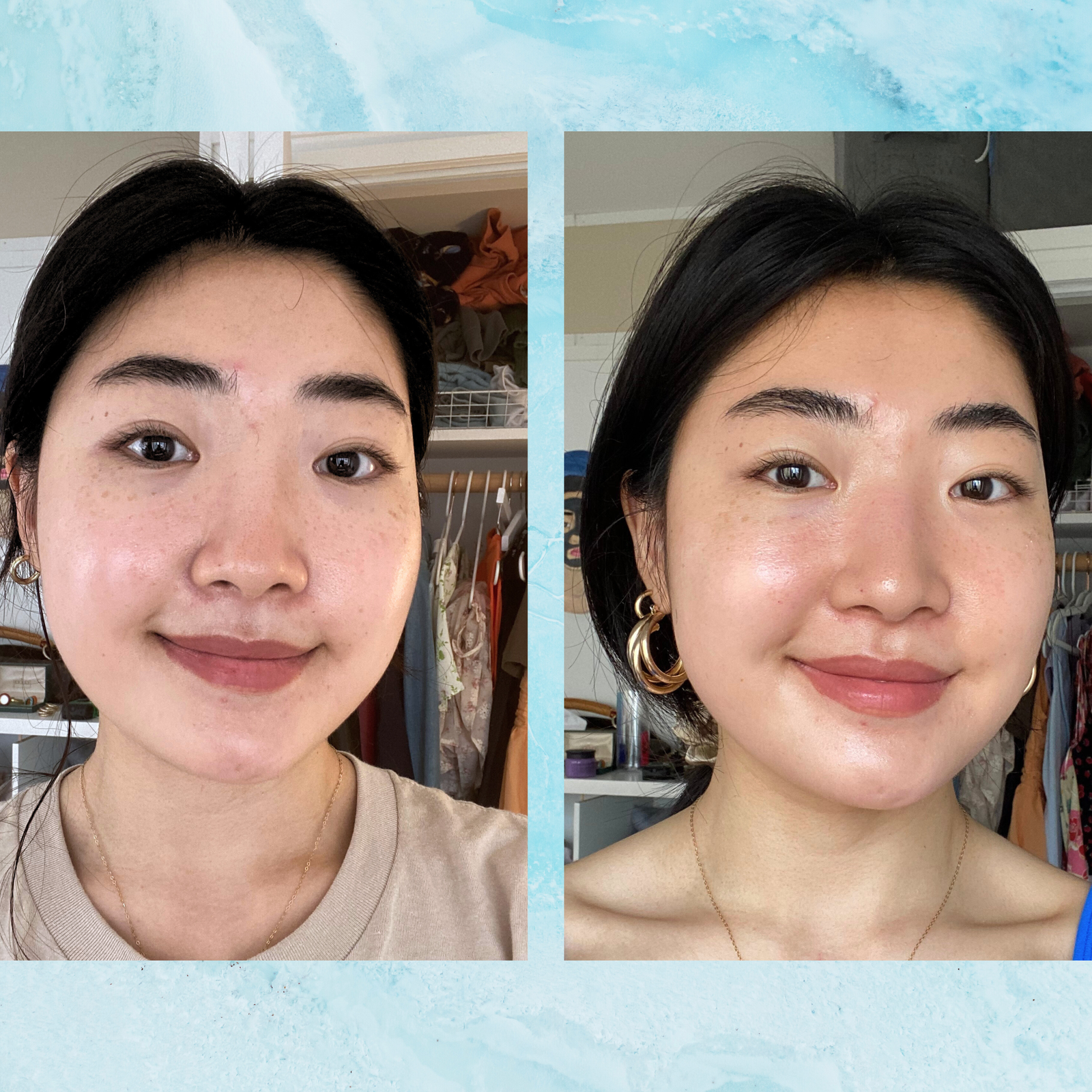 I Tried the Viral HydraFacial for My Ultrasensitive Skin